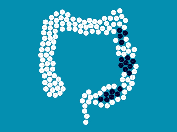 Types of Colon Polyps Colon Polyp Symptoms and Risk Factors