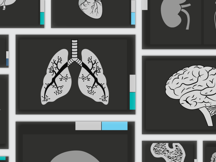 Illustration of x-ray imaging